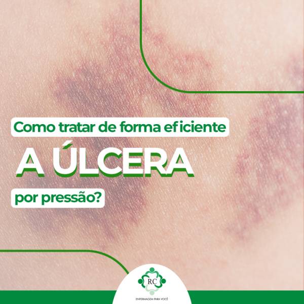 Como tratar de forma eficiente a úlcera por pressão?