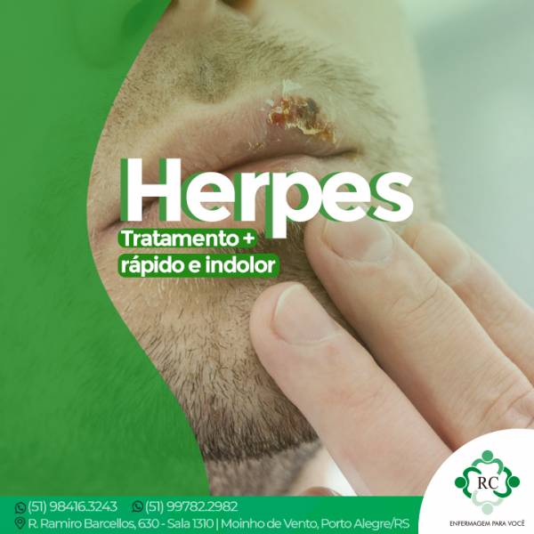 Herpes: Tratamento + rápido e indolor