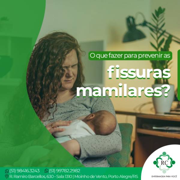 O que fazer para prevenir as fissuras mamilares?