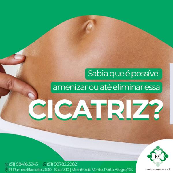 Sabia que é possível amenizar ou até eliminar essa cicatriz?